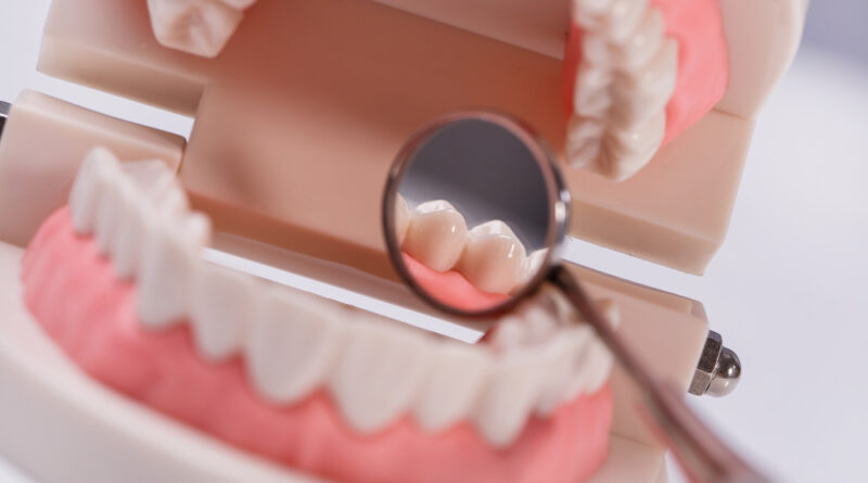 dbanie o protezę zębową