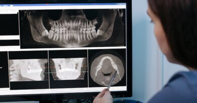 Czy RTG wykryje wszystkie problemy z zębami?